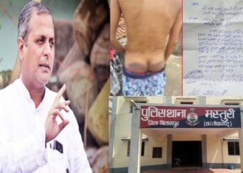 बिलासपुर पुलिस का अमानवीय चेहरा,पुलिस को बर्बरता से पिटाई करने का अधिकार नहीं : शैलेष पाण्डेय